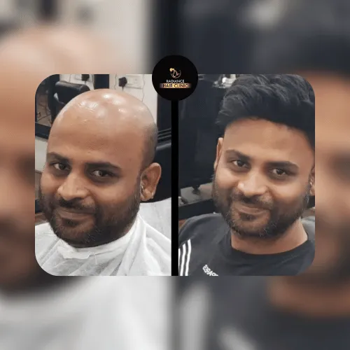 Hair Weaving Transformation - Before