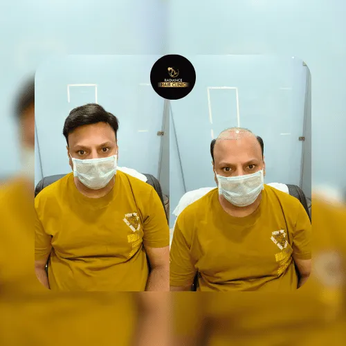 Hair Extension Makeover - Before